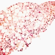 liver