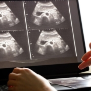 abdominal ultrasound